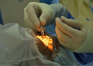 A cataract surgery Pic: Wikimedia Commons